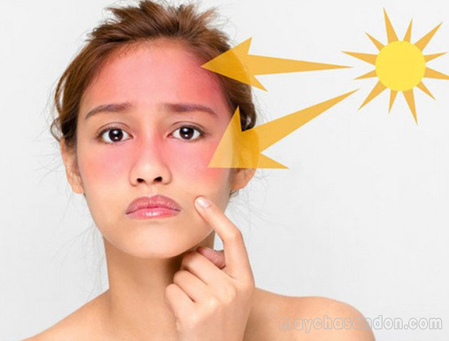 Da mặt trở nên kích ứng với tia UV sau khi sử dụng BHA